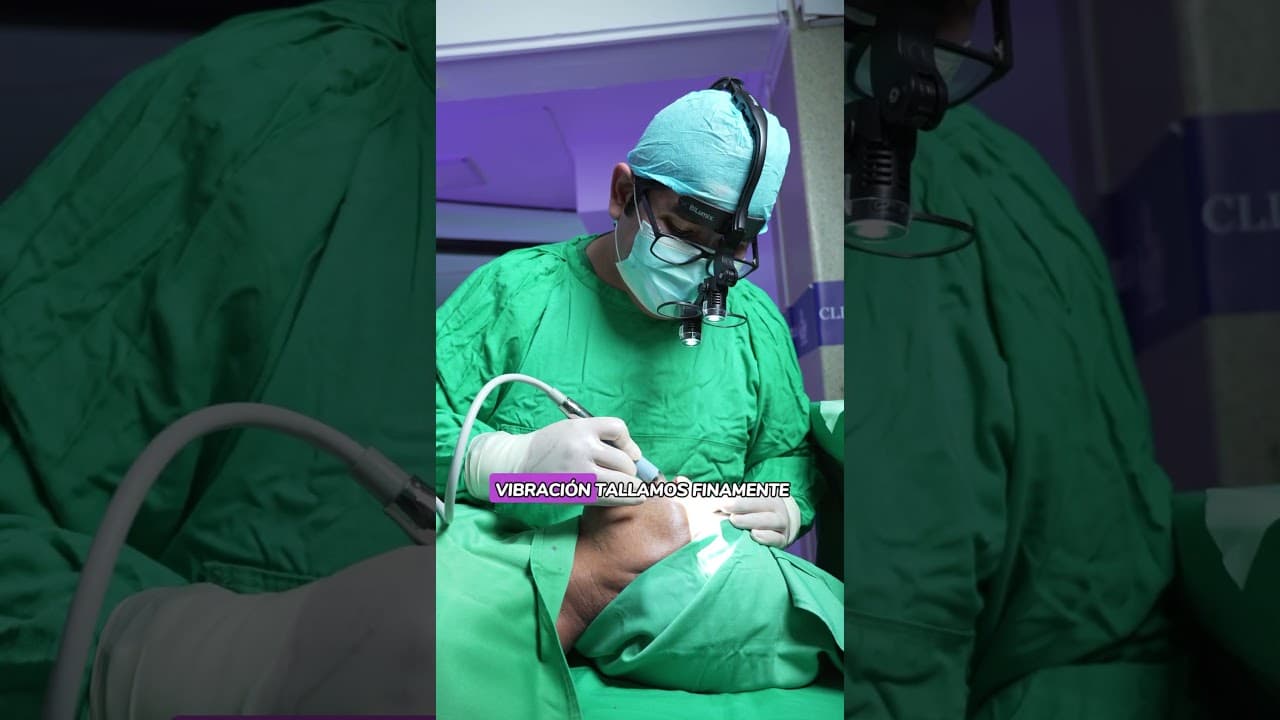 Rinoplastia ultrasónica vs convencional
