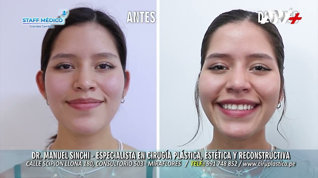 Caso real de OTOPLASTIA